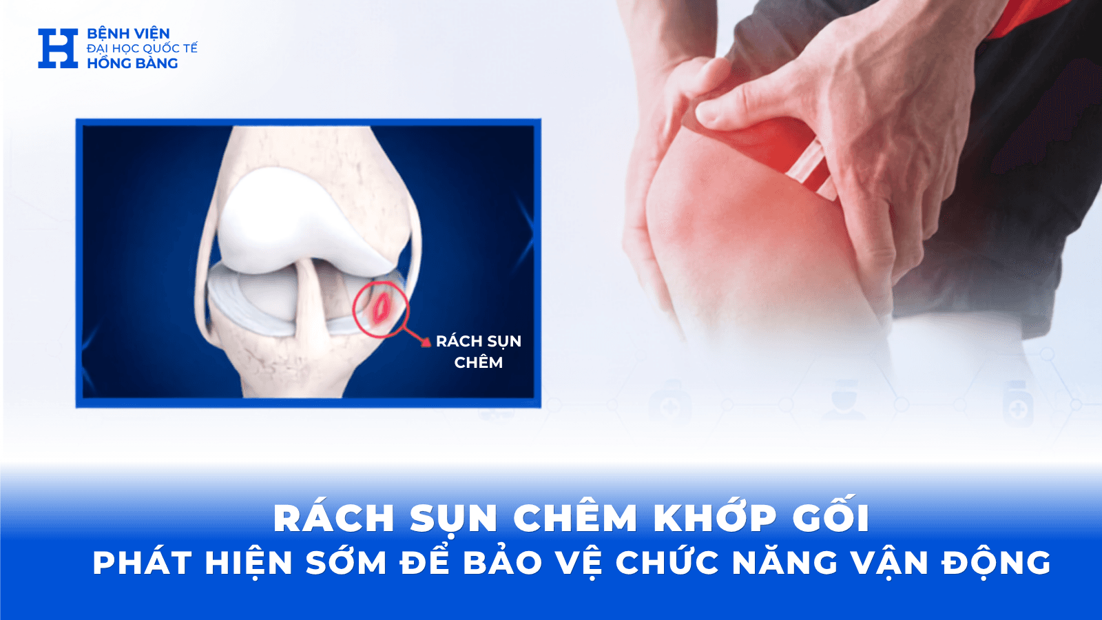 Rách sụn chêm khớp gối: Phát hiện sớm để bảo vệ chức năng vận động