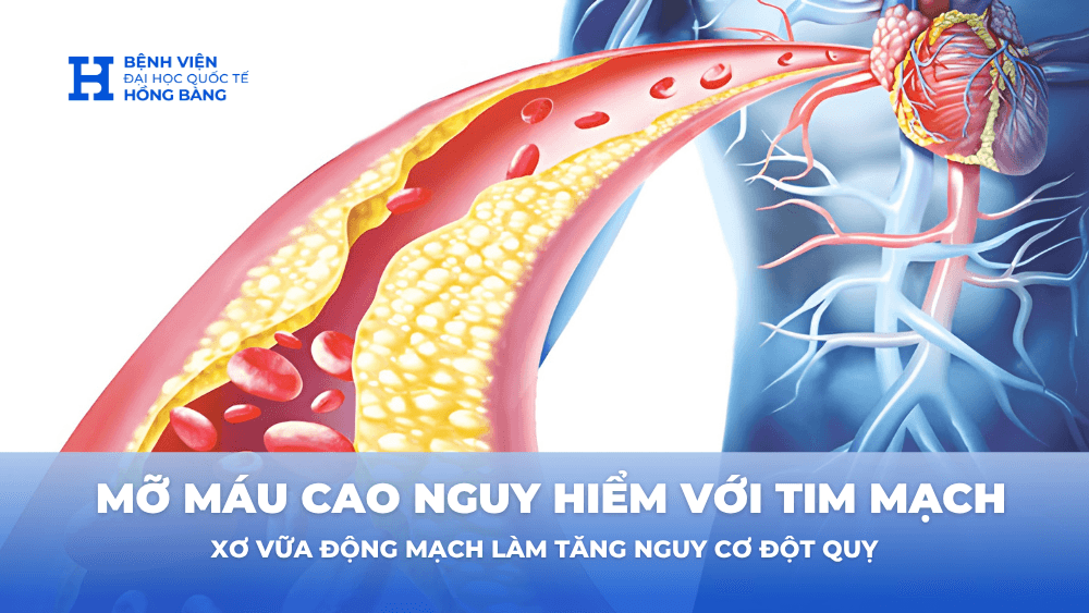 Mỡ máu cao nguy hiểm như thế nào với tim mạch và đột quỵ?