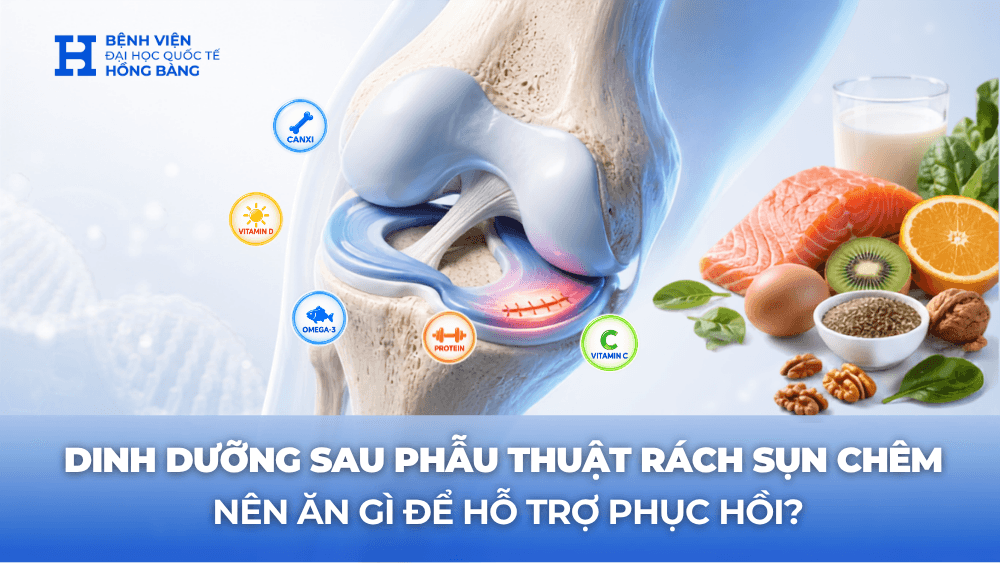 Dinh dưỡng sau mổ rách sụn chêm: Ăn gì để nhanh phục hồi?
